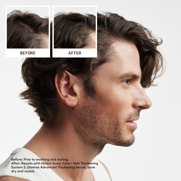 Hair System Kit 2 (Bild 2 von 6)